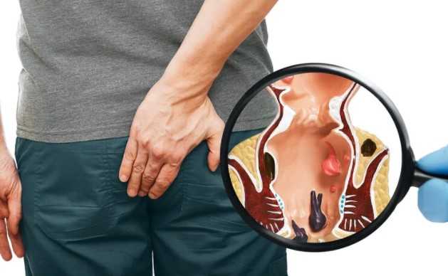 Hernia Specialist in Pune
